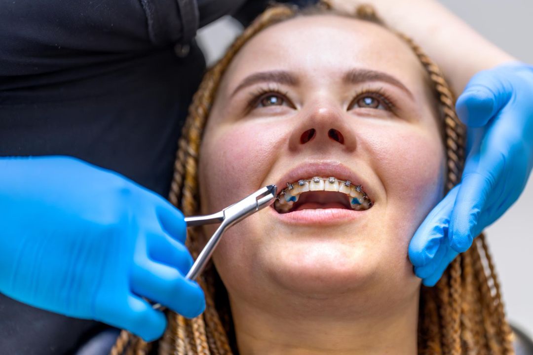 can braces fix jaw problems and bite issues